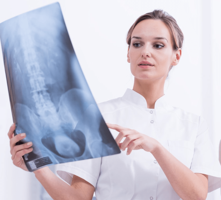 Diagnosis osteochondrosis toraks dengan pemeriksaan sinar-X