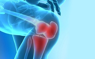 bagaimana arthrosis sendi lutut menampakkan dirinya
