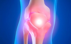 penyebab arthrosis sendi lutut