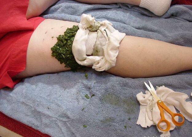 Mampat hangat daun kubis yang dihancurkan pada sendi lutut yang sakit dengan arthrosis